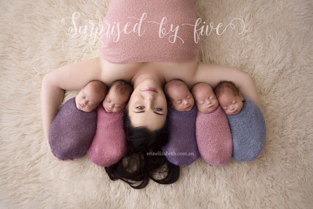 This Woman Gave Births To Five Babies In Just Two Minutes Which Happens Only Once in 55 Million. Tomatoheart.com 1