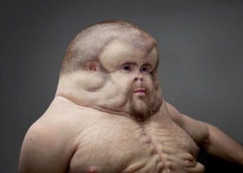 graham body survive car crash road safety victorian government patricia piccinini | Meet Ugly Graham, The World's First & Only Human Designed to Survive Any Car Crash iPhone 7 | 12 Meet Ugly Graham, The World's First & Only Human Designed to Survive Any Car Crash Tomatoheart.com 1